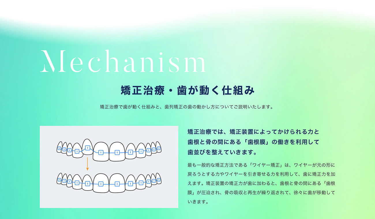 矯正治療・歯が動く仕組み｜矯正治療で歯が動く仕組みと、歯列矯正の歯の動かし方についてご説明いたします。