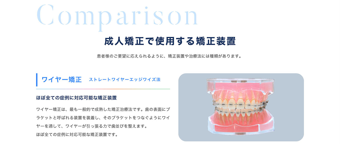 成人矯正で使用する矯正装置｜患者様のご要望に応えられるように、矯正装置や治療法には種類があります。