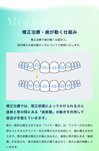 矯正治療・歯が動く仕組み｜矯正治療で歯が動く仕組みと、歯列矯正の歯の動かし方についてご説明いたします。