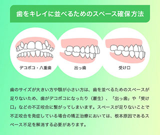 歯をキレイに並べるためのスペース確保方法