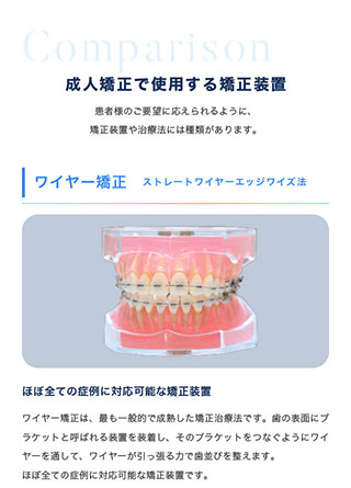 成人矯正で使用する矯正装置｜患者様のご要望に応えられるように、矯正装置や治療法には種類があります。